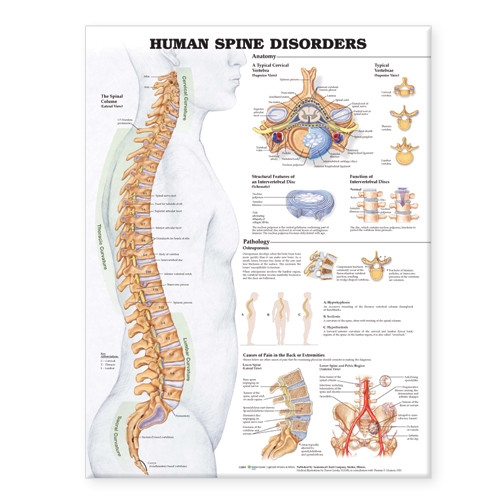 NBN Planche The Human Spine Disorders