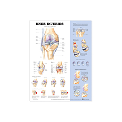 NBN Planche Knee Injuries