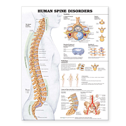 NBN Planche The Human Spine Disorders